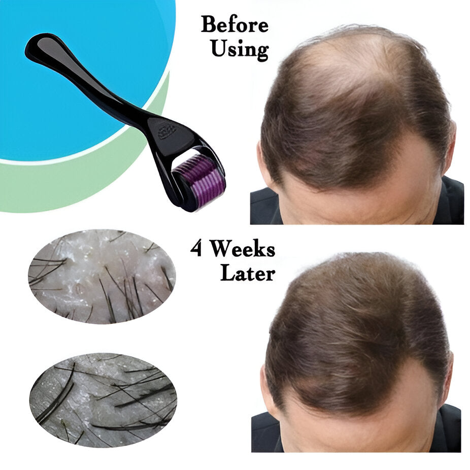Combo Pack Derma Roller + Hair Oil Applicator Bottle + Hair Scalp Massager | Pack Of 3 Deal